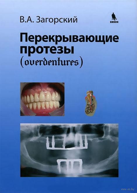 Протезы