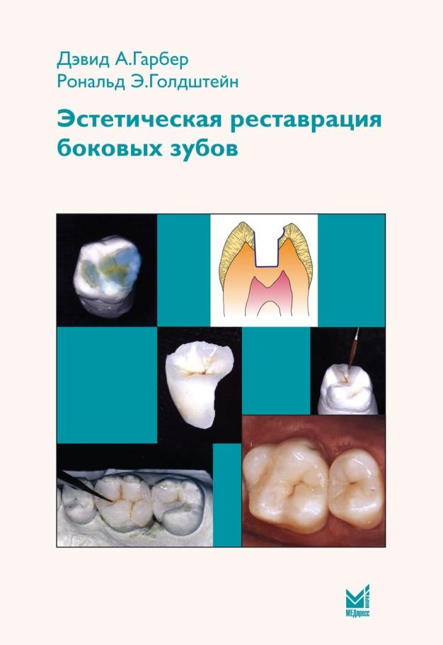 Реставрация